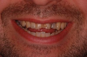 Before - Stoke Bishop Dental Centre