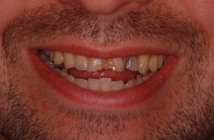 Before - Stoke Bishop Dental Centre