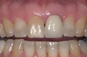 Before - Stoke Bishop Dental Centre