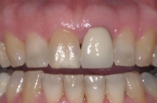 Before - Stoke Bishop Dental Centre
