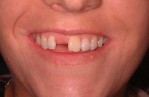 Before - Stoke Bishop Dental Centre