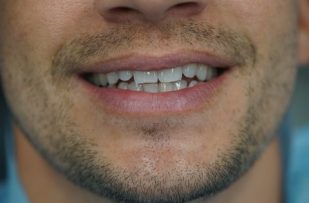 Before - Stoke Bishop Dental Centre
