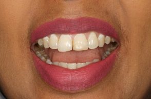 Before - Stoke Bishop Dental Centre