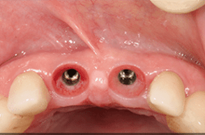 Before - Stoke Bishop Dental Centre