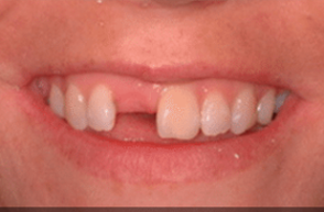 Before - Stoke Bishop Dental Centre