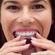 woman putting in aligners