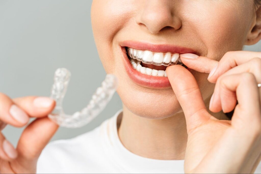 lady holding invisalign aligners