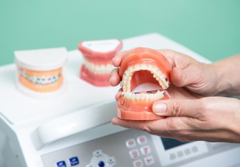 Stoke Bishop Dental Centre